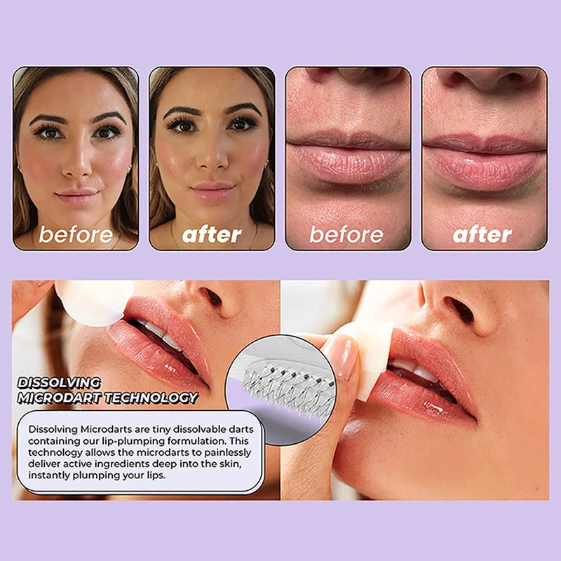 Patch pour les Lèvres Microneedling Réutilisable - Hydrate & Repulpe
