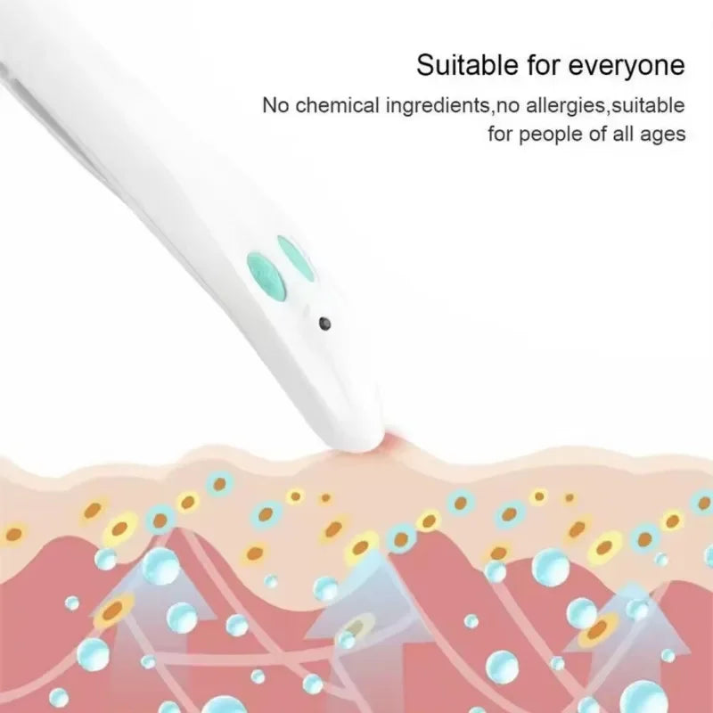 Stylo Anti-Démangeaisons Piqûre de Moustique