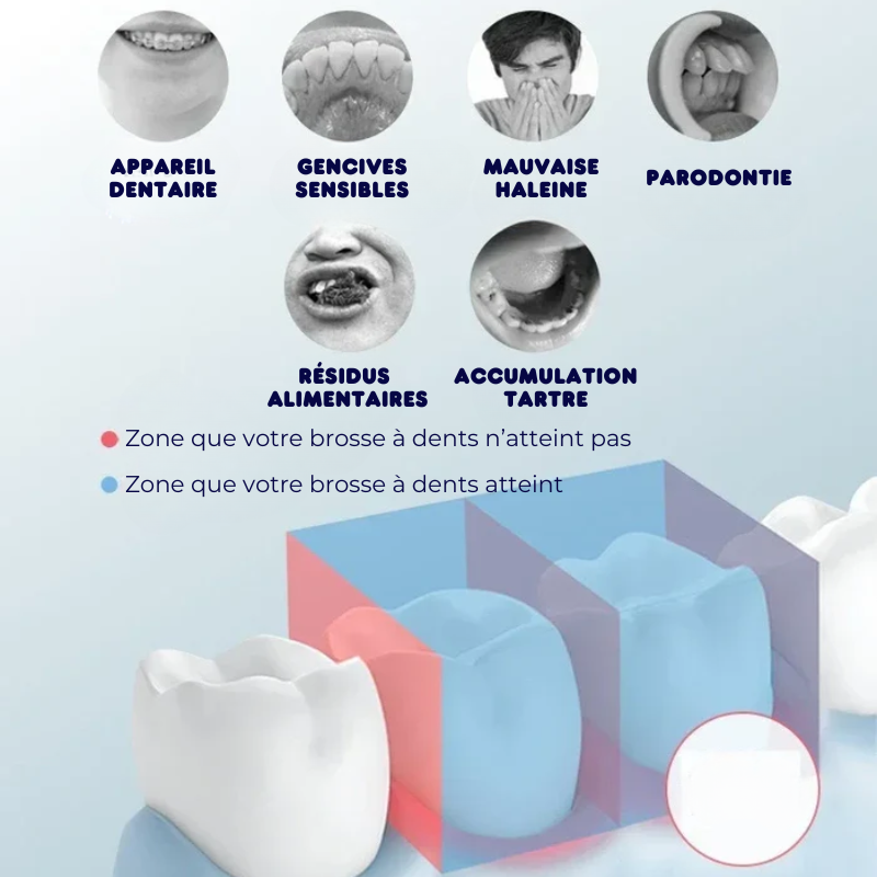 Irrigateur dentaire manuel portable