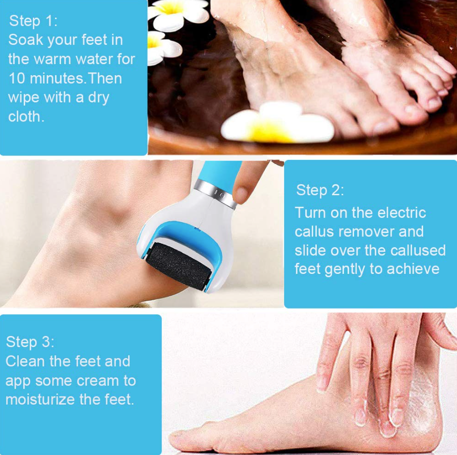 Lime électrique anti-callosité pour pieds